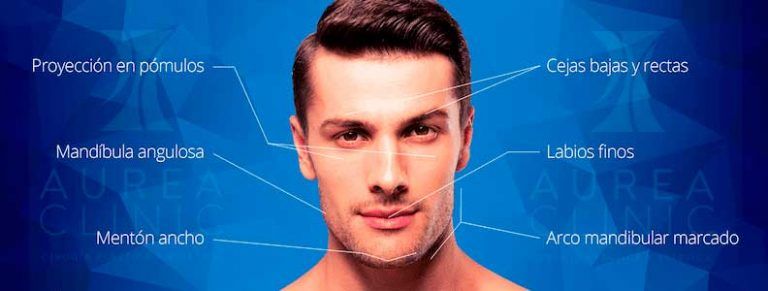 Masculinización facial Relleno de menton para masculinizar el rostro en hombres