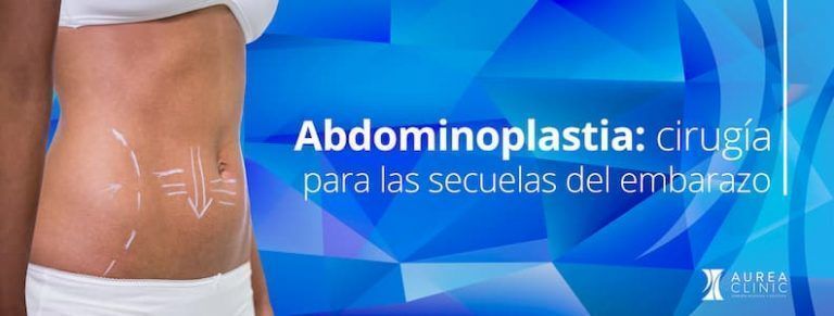 Abdominoplastia Para Las Secuelas Embarazo en Sevilla