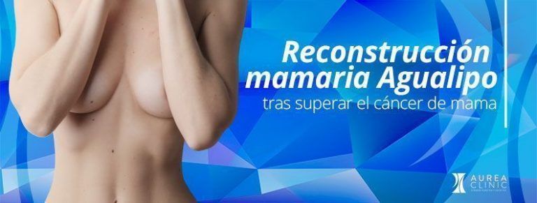 Reconstrucción mamaria sin prótesis tras superar un cáncer de mama, lipofilling mamario Agualipo