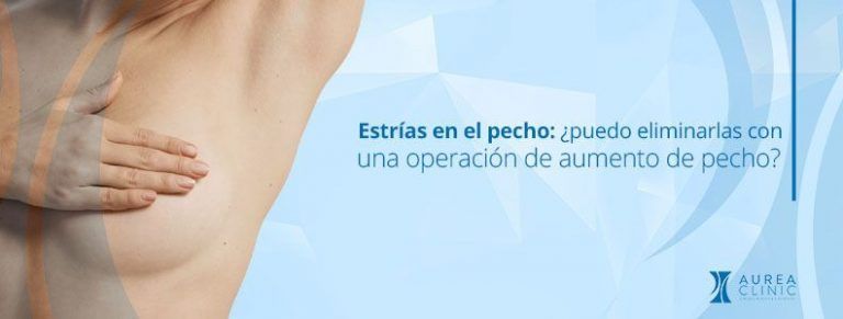 estrías aumento de pecho