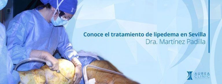 tratamiento de lipedema en Sevilla Dra. Martinez Padilla
