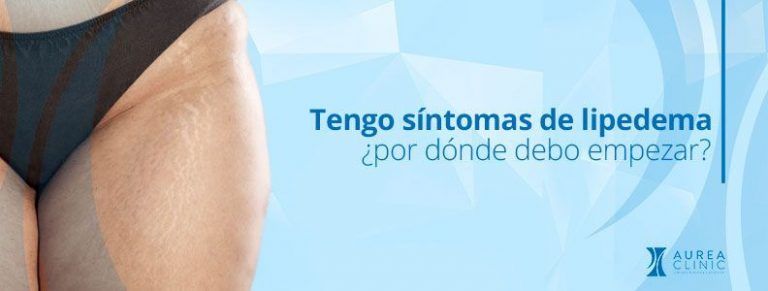 sintomas de lipedema sevilla andalucia