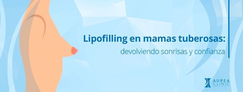 lipofilling mamario mamas tuberosas Sevilla