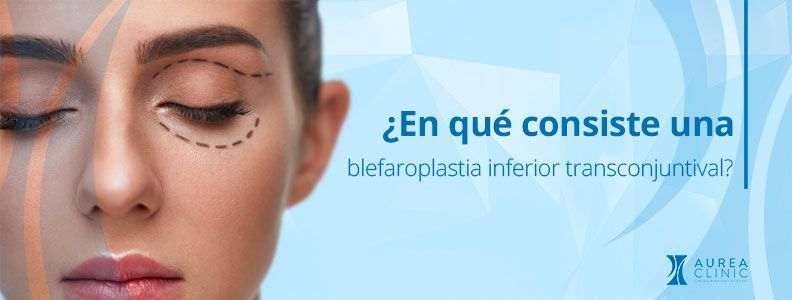 blefaroplastia inferior transconjuntival Sevilla