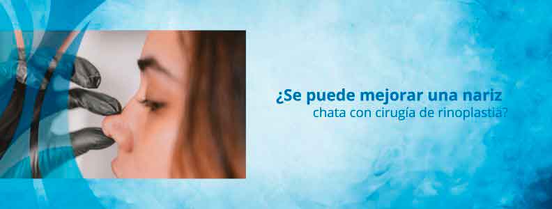 nartiz chata sevilla