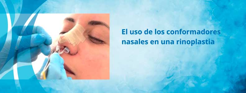 por qué usamos un conformador nasal tras una rinoplastia