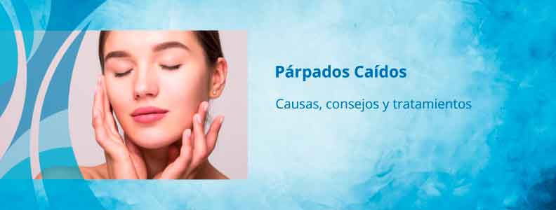 Párpados caídos
