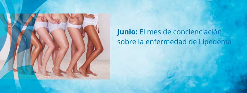 Junio, mes de concienciación sobre Lipedema