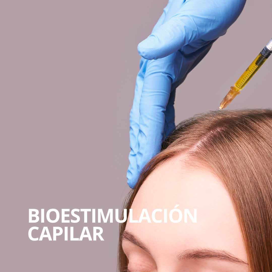bono bioestimulación capilar Sevilla