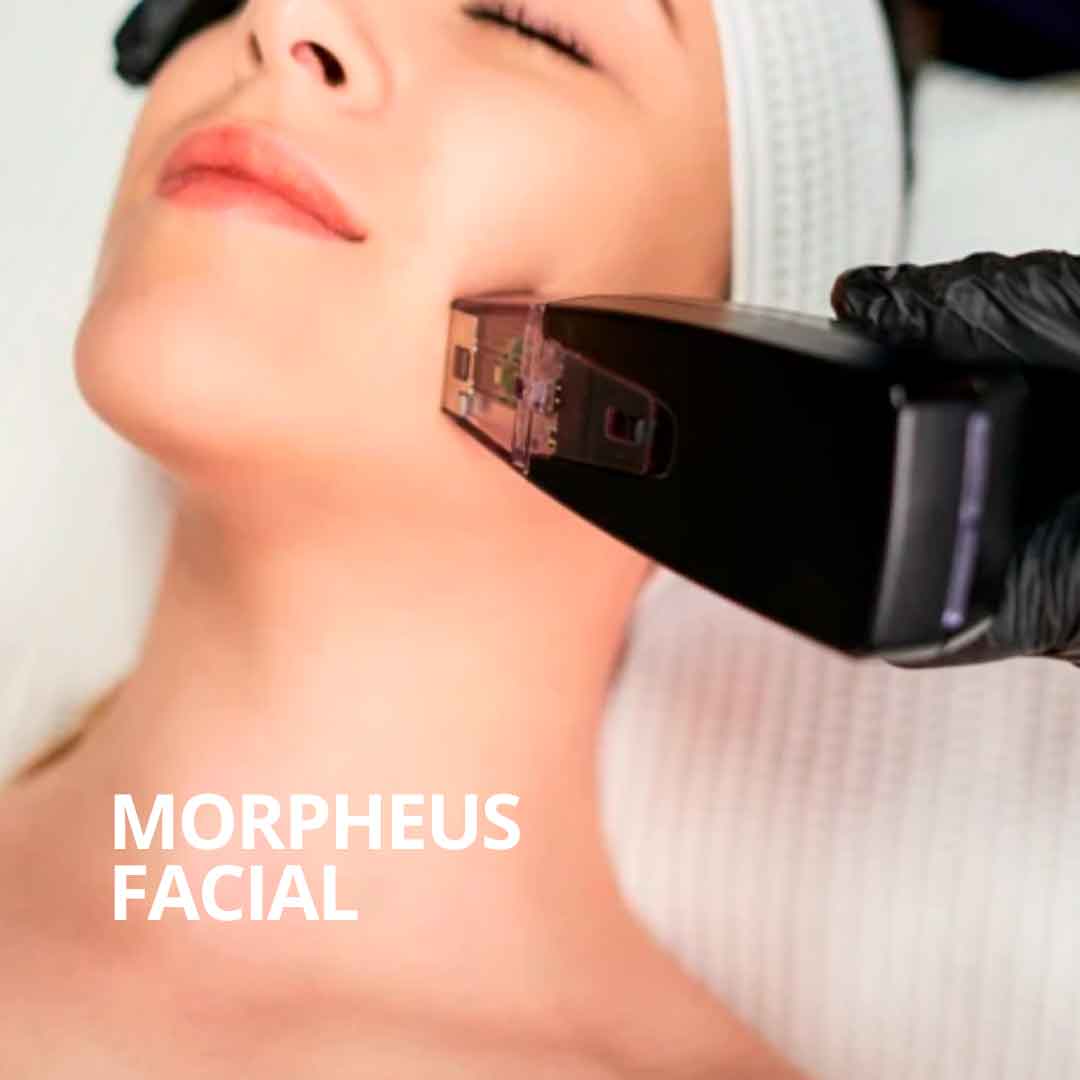 bono Morpheus8 facial Sevilla
