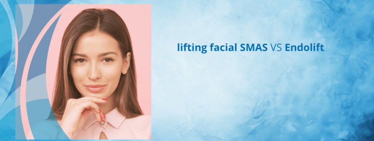 lifting facial SMAS o endolift