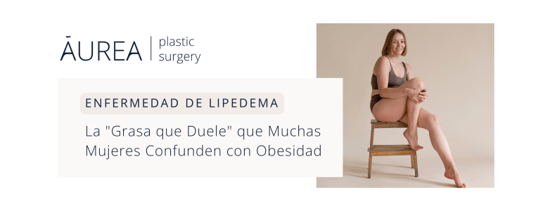 lipedema la grasa que duele