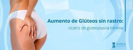 Aumento de Glúteos sin rastro: cicatriz de gluteoplastia mínima Sevilla