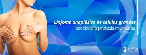 Revisión prótesis mamarias Sevilla