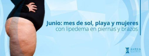 lipedema-en-piernas-sevilla-aurea-clinic