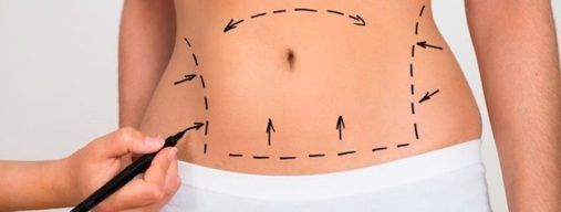 lipofilling Sevilla, lipotransferencia de grasa con Agualipo