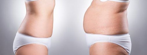 Liposucción WAL asistida por agua Sevilla