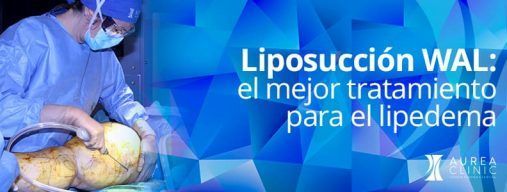 El mejor tratamiento para el lipedema es la liposucción WAL