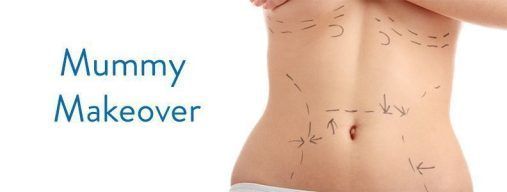 Mummy Makeover Sevilla