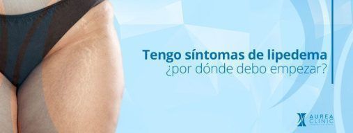 sintomas de lipedema sevilla andalucia