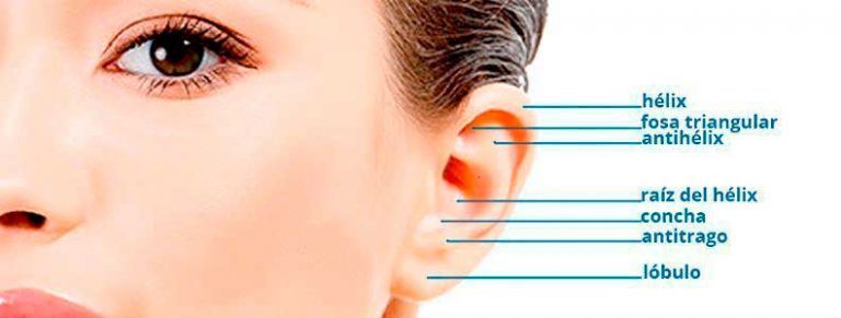 Otoplastia VS Earfold