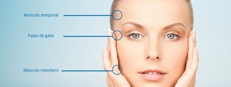 uso del botox para migrañas y para bruxismo