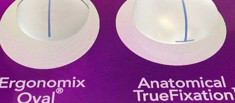 Prótesis Antirotación Motiva True FIxation