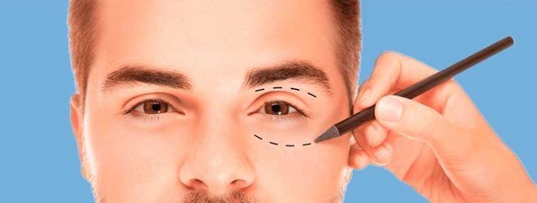 Intervención de blefaroplastia en hombre joven Sevilla