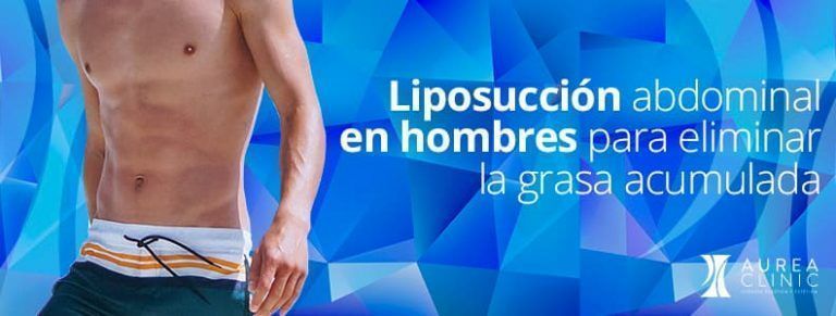 Liposucción abdominal en hombres para eliminar la grasa localizada
