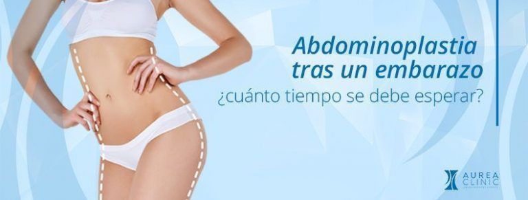 ¿Cuánto hay que esperar para una abdominoplastia tras un embarazo?
