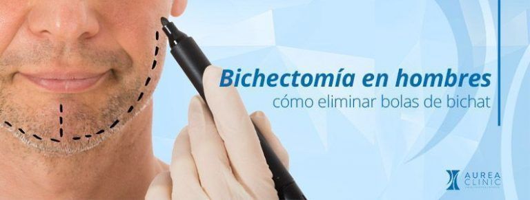 bichectomía en hombres Sevilla