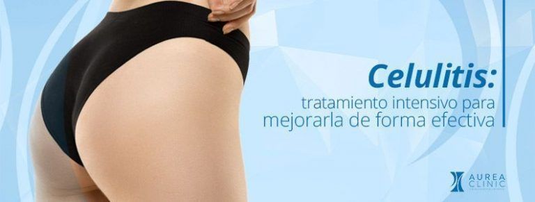 Tratamientos para reducir la celulitis