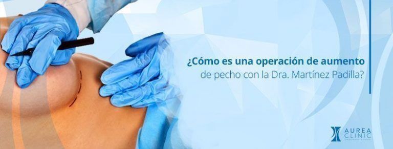 operación aumento de pecho Sevilla Aurea Clinic