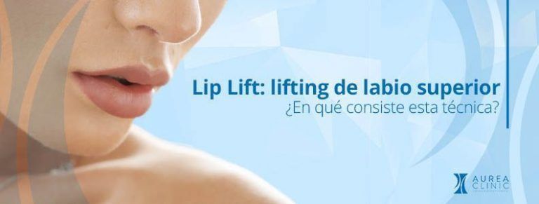 lifting de labio superior Aurea Clinic Sevilla