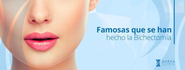 famosas que se han hecho la bichectomía Sevilla