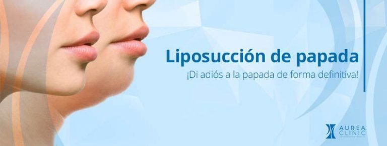 ¡Di adiós a la papada de forma definitiva!