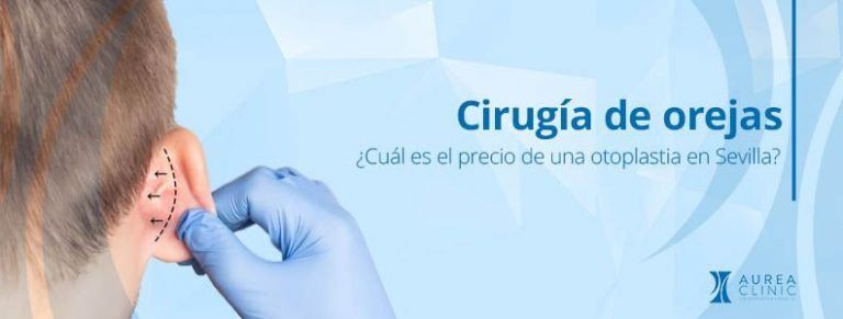 otoplastia precio Sevilla