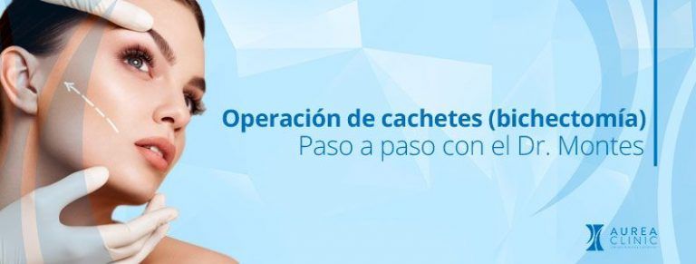 operación de cachetes bichectomía Sevilla