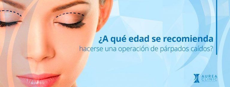 edad cirugía párpados caídos (blefaroplastia)