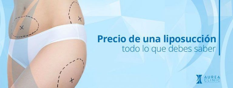 liposucción precio Sevilla