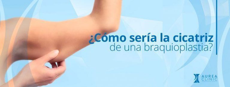 cicatriz braquioplastia