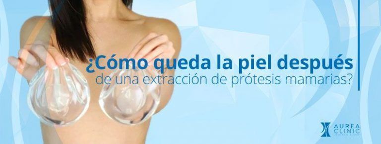 cómo queda la piel después de una extracción de prótesis Sevilla