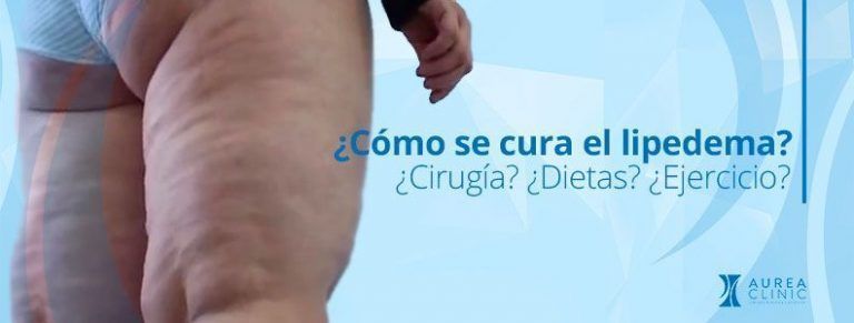 curar el lipedema