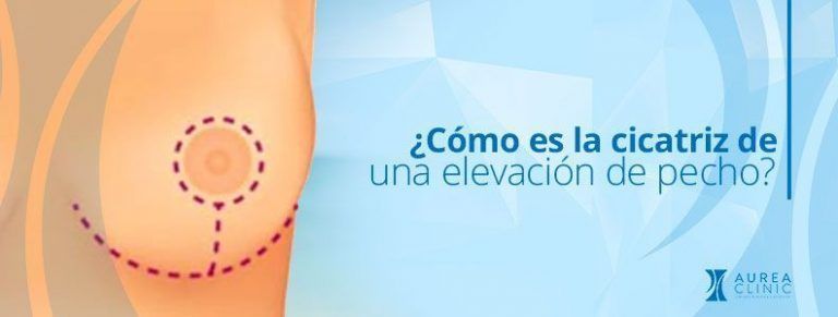 elevación mamaria cicatriz