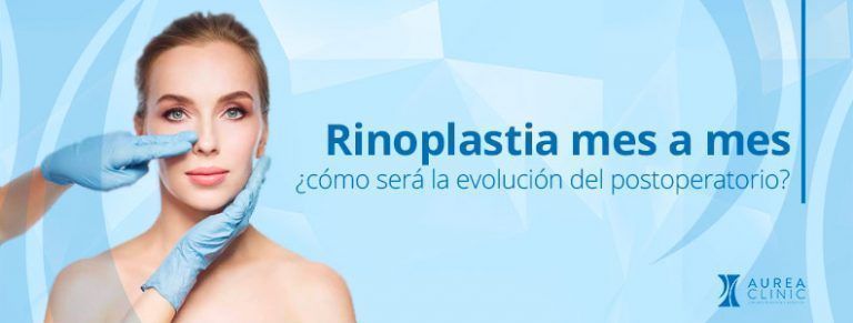 rinoplastia mes a mes sevilla