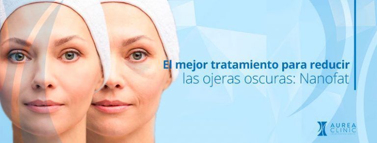 mejor tratamiento para reducir las ojeras oscuras sevilla