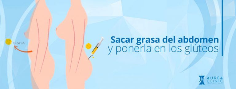 sacar grasa del abdomen y ponerla en los glúteos sevilla