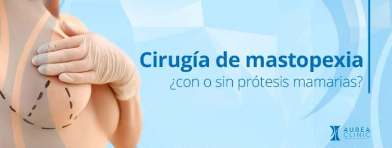 Mastopexia con o sin prótesis Sevilla