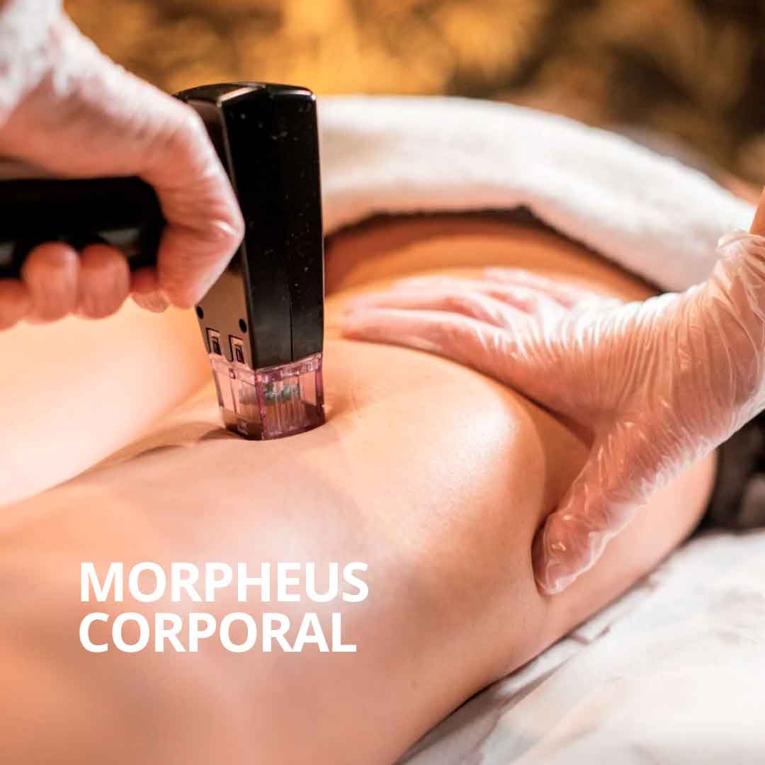 Bono morpheus8 coporal