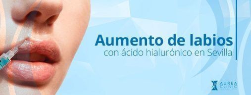 aumento de labios acido hialurónico en Sevilla